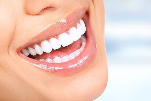 Teeth Whitening in Wyomissing,PA